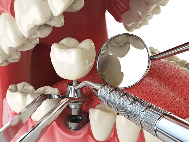 Best Emergency Dental Services for Seniors in Clementon, NJ